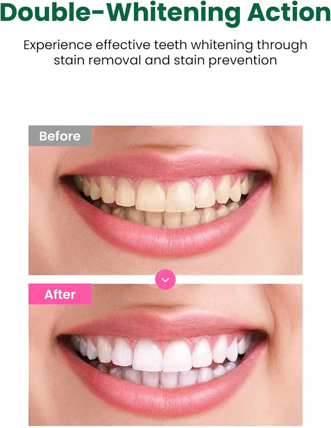 image:imageEUTHYMOL Whitening Toothpaste 37fl oz5 Pack of 5 Stain Removal in 2 Weeks LongLasting Freshness for Sensitive Gum amp Teeth Bad Breath Cavity Prevention Recyclable Aluminum TubePack of 1